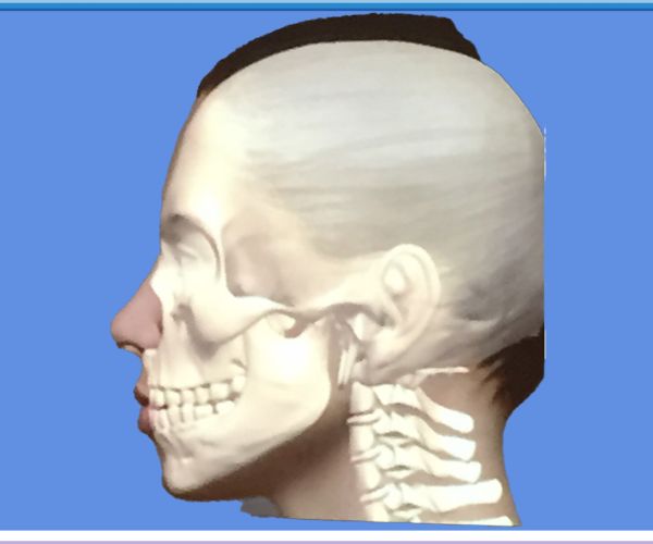 bone2-involution