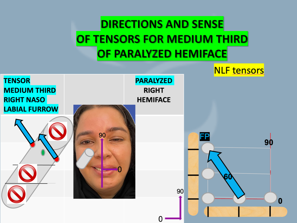 tensors of 60 grades with the horizontal