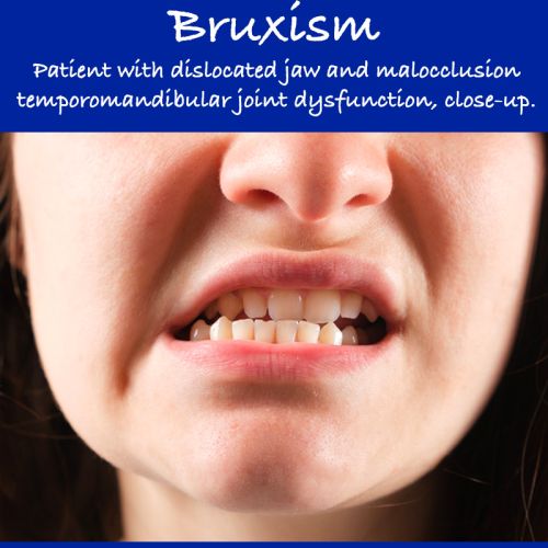 bruxism-hero