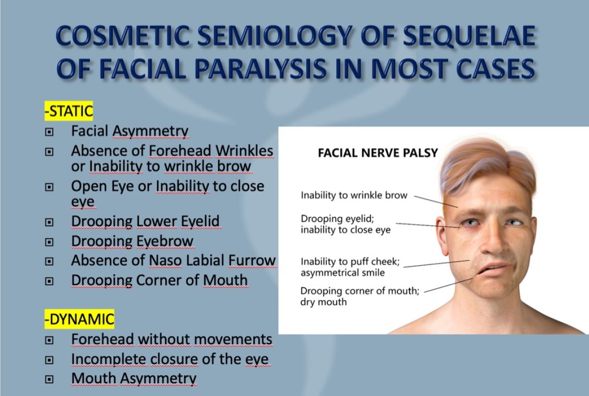 Cosmetic Semiology of Paralysed Hemiface